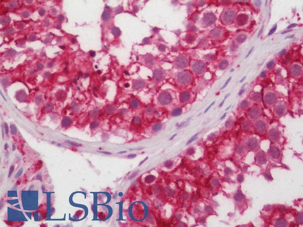 IHC-plus™ EGFR Antibody (aa661-710)