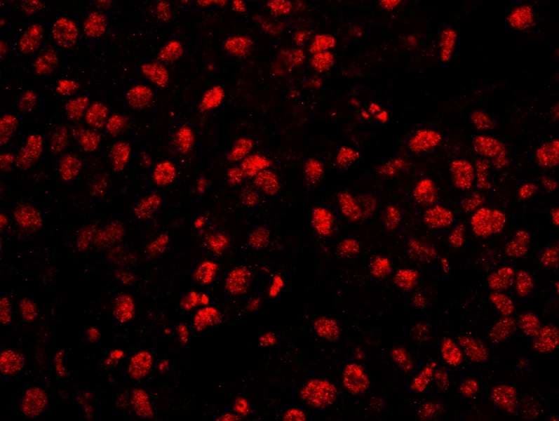 Polyclonal Rabbit anti-Human CPSF160 / CPSF1 Antibody (aa1392-1442, IHC, IF)