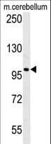 Polyclonal Rabbit anti-Human EPC2 Antibody (aa205-233, WB)