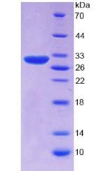 Human SERPINB3 Protein (Recombinant His, N-Terminal)