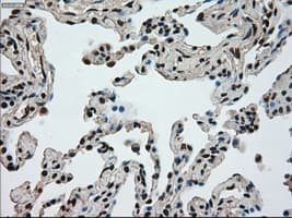 Monoclonal Mouse anti-Human MKI67 / Ki67 Antibody (clone OTI3D11, IHC, WB)