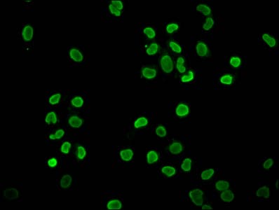 HIST1H4I Antibody
