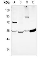 Polyclonal Rabbit anti-Human DKK3 Antibody (WB)