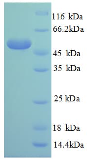 Human RPL14 / Ribosomal Protein L14 (Recombinant GST)