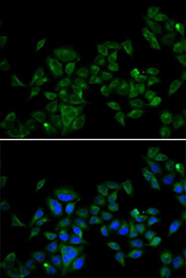 Polyclonal Rabbit anti-Human MAGED1 / NRAGE Antibody (IHC, IF, WB)