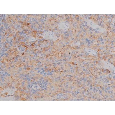 SYN / FYN Antibody (phospho-Tyr530)