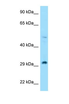 Polyclonal Rabbit anti-Human RPL7 / Ribosomal Protein L7 Antibody (N-Terminus, WB)