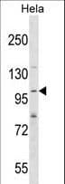 SH3PXD2A / TKS5 Antibody (aa222-250)