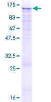 Human EZH2 Protein (Recombinant GST)