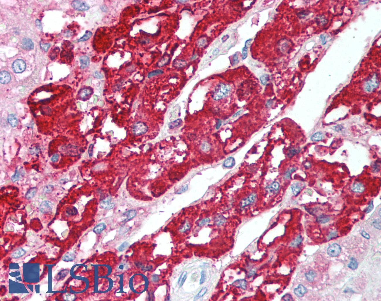 Polyclonal Rabbit anti-Human CHGA / Chromogranin A Antibody (C-Terminus, IHC, WB)