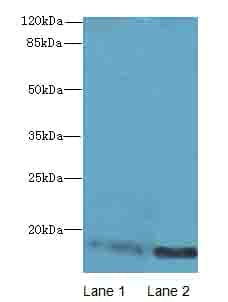 IHC-plus™ CRABP1 / CRABP Antibody