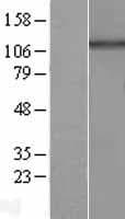 HPS5 Protein (Over-Expression Lysate Myc-DDK (Flag))
