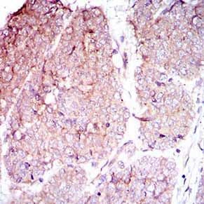 ITGB4 / Integrin Beta 4 Antibody (Amino Acid: 1619-1822, clone 10B10D5)