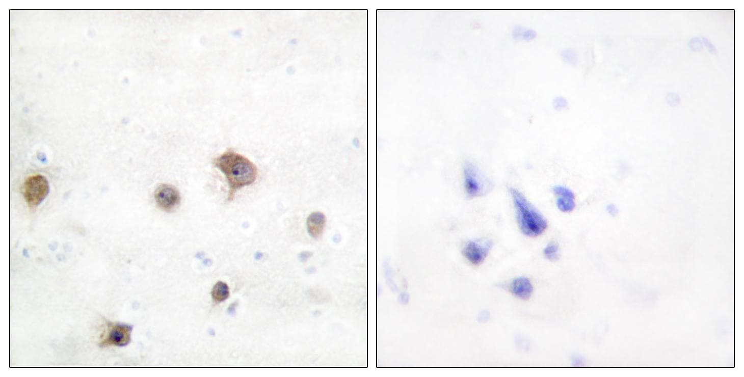 Polyclonal Rabbit anti-Human MAPK8IP2 / JIP2 Antibody (IHC, IF, WB)