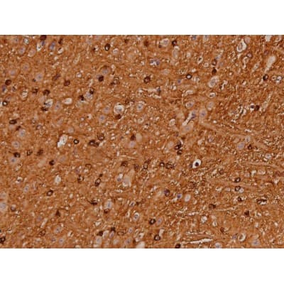 MAPT / Tau Antibody (phospho-Ser262)