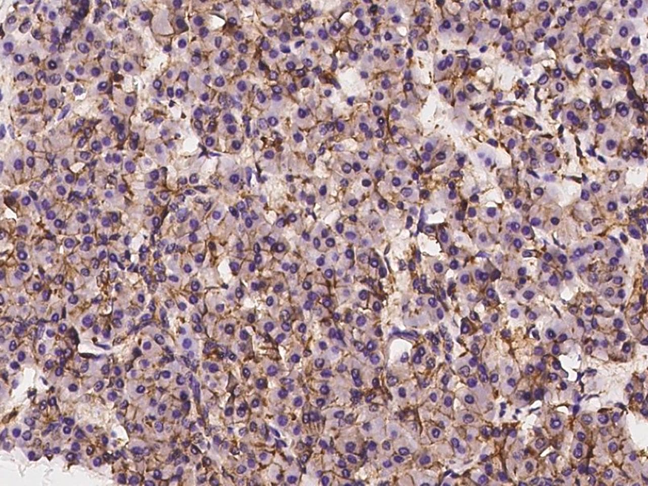 SLC43A1 Antibody
