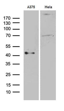 PHLDA1 Antibody (aa183-401, clone OTI4G2)