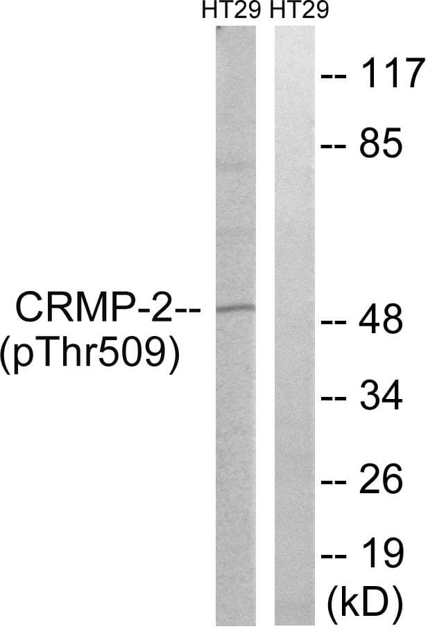 DPYSL2 / CRMP2 Antibody (phospho-Thr509)