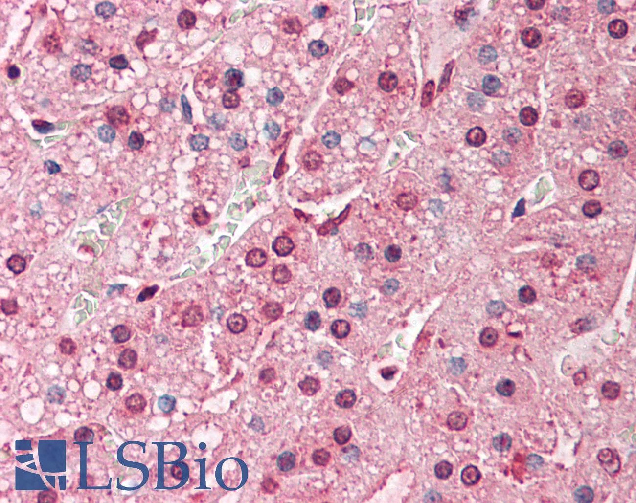 IHC-plus™ Polyclonal Rabbit anti-Human QSOX2 Antibody (Internal, IHC)