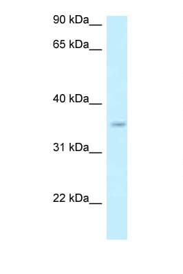 Polyclonal Rabbit anti-Human GPN3 Antibody (aa230-279, WB)