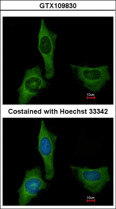 Polyclonal Rabbit anti-Human F10 / Factor X Antibody (aa33-312, IHC, WB)
