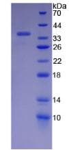 Human ERN1 / IRE1 Protein (Recombinant His-T7)