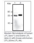 Monoclonal Mouse anti-Human LPL / Lipoprotein Lipase Antibody (clone LPL.A4, WB)