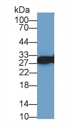 VAP33 / VAPA Antibody (aa1-249, PE)