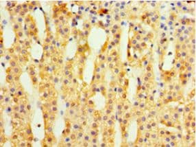 BM022 / MRPL1 Antibody (aa51-324)