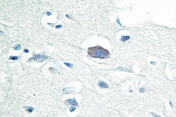 IRAK3 / IRAKM / IRAK-M Antibody (Leu519)