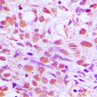 SENP2 Antibody (C-Terminus)