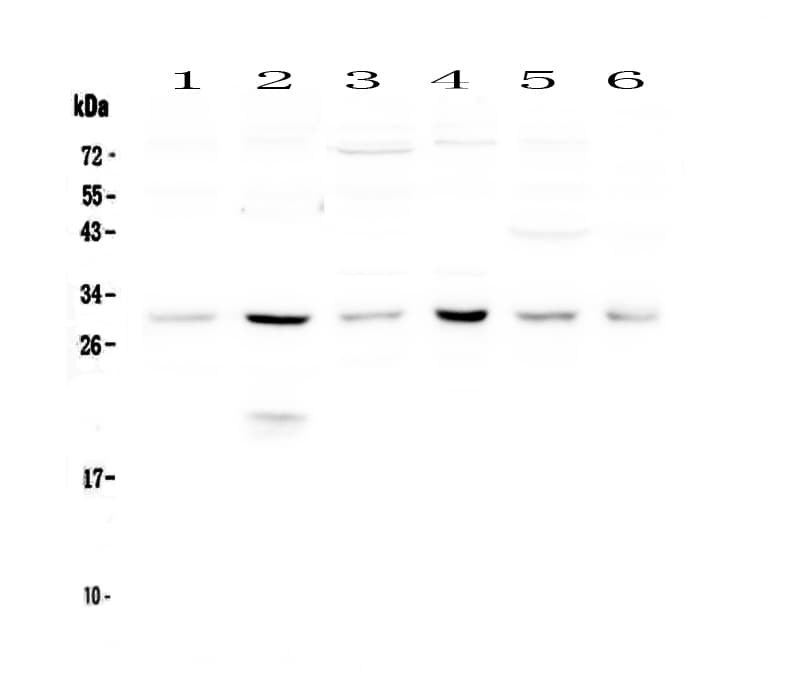 DCK / Deoxycytidine kinase Antibody