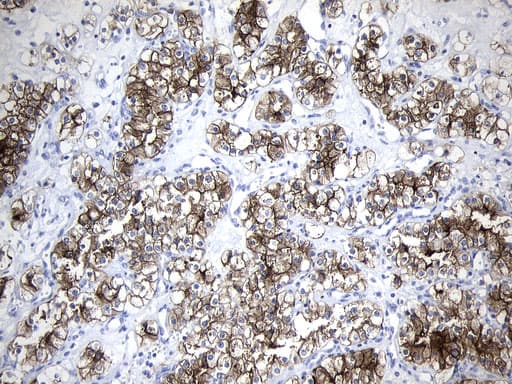 MME / CD10 Antibody (aa411-750, clone UMAB236)