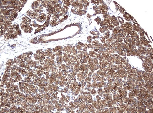 KRT8 / CK8 / Cytokeratin 8 Antibody (aa91-381, clone UMAB1, Carrier-free)