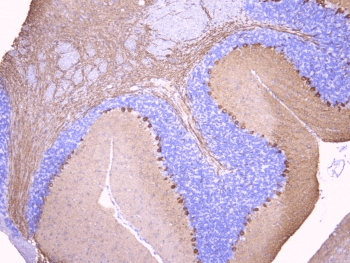 Polyclonal Rabbit anti-Human PRKCG / PKC-Gamma Antibody (IHC, WB)