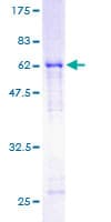 Human SET / TAF-I Protein (Recombinant GST)
