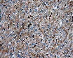 PIM2 / Pim-2 Antibody (clone OTI8G10)