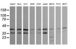 MAPK9 / JNK2 Antibody (clone OTI1A1)