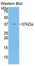 ARG1 / Arginase 1 Antibody (aa1-323)