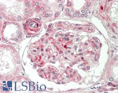 IHC-plus™ VCL / Vinculin Antibody (aa1016-1066)