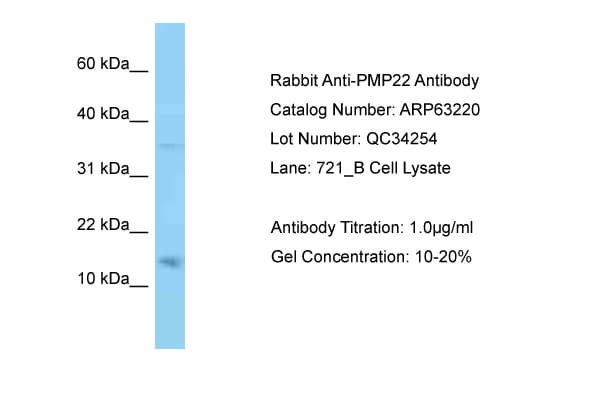 PMP22 Antibody (aa27-76)