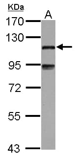 Polyclonal Rabbit anti-Human MAP7 Antibody (C-Terminus, IHC, WB)