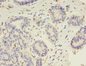 RAD17 Antibody (aa1-270)