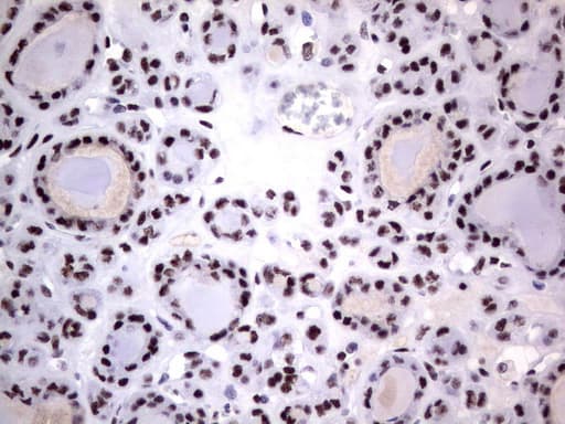 DDX56 Antibody (aa323-547, clone UMAB153)