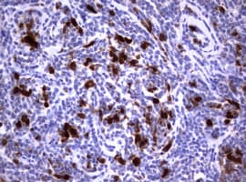 PathPlus™ TS / Thymidylate Synthase Antibody (clone 3F1)