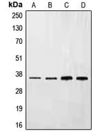 EFNB3 / Ephrin B3 Antibody (C-Terminus)