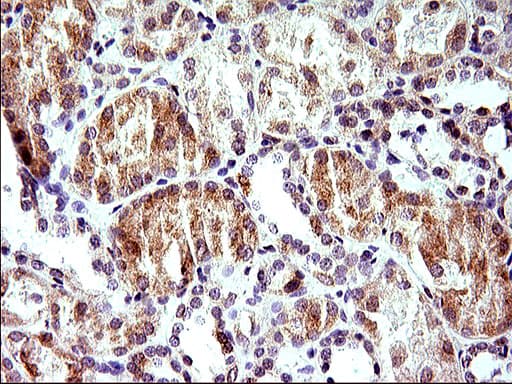 HERPUD1 / HERP Antibody (clone OTI1A2)