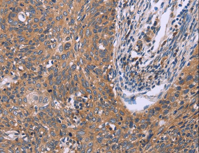 CSF2RB / CD131 Antibody