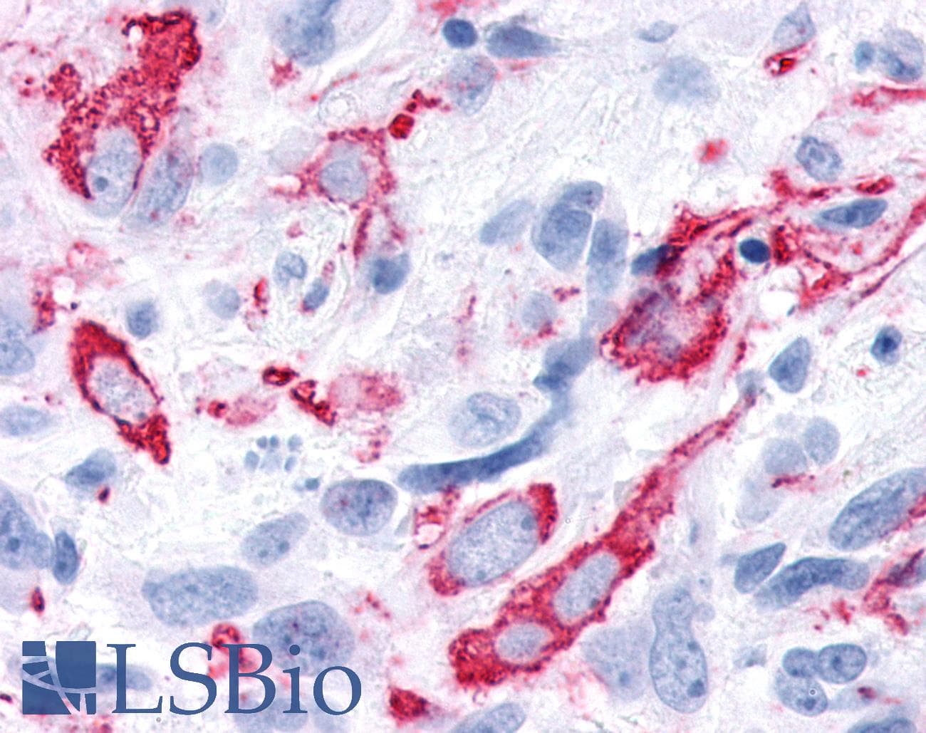 PathPlus™ FAK / Focal Adhesion Kinase Antibody (C-Terminus)