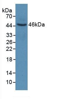 KRT6A / CK6A / Cytokeratin 6A Antibody (aa163-468)